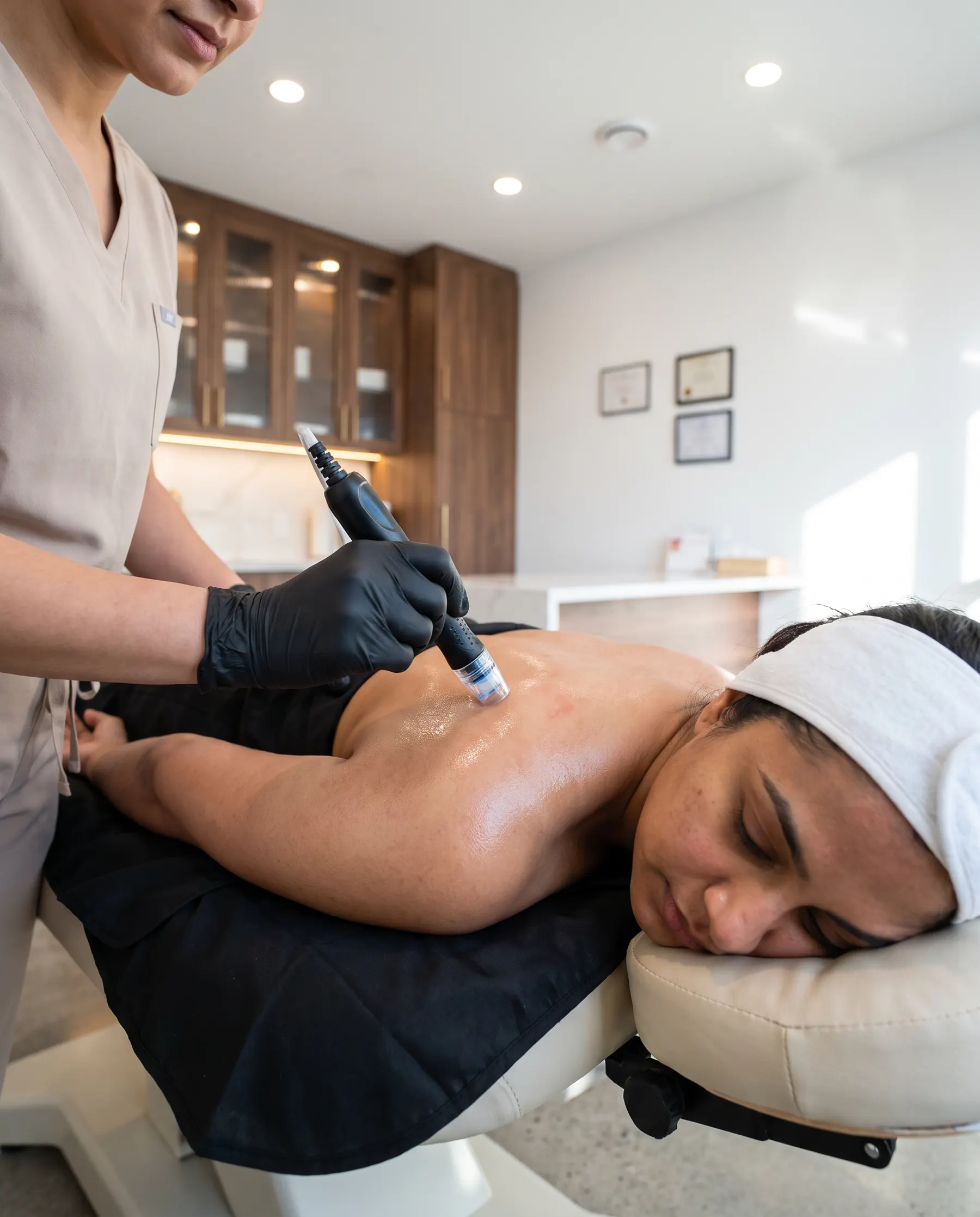 The exfoliating tip passing between the shoulder blades