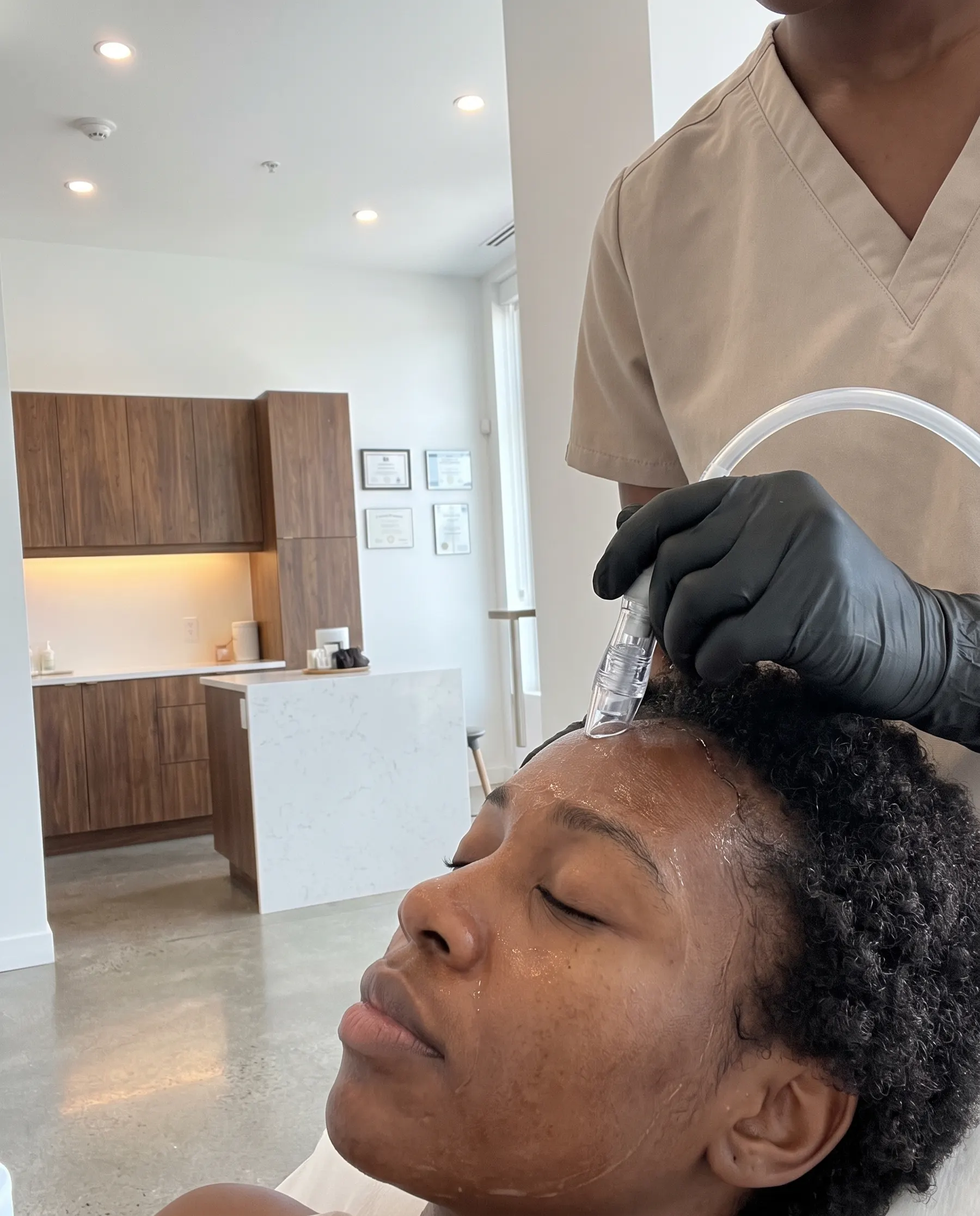 The first tip on the forehead, close framing