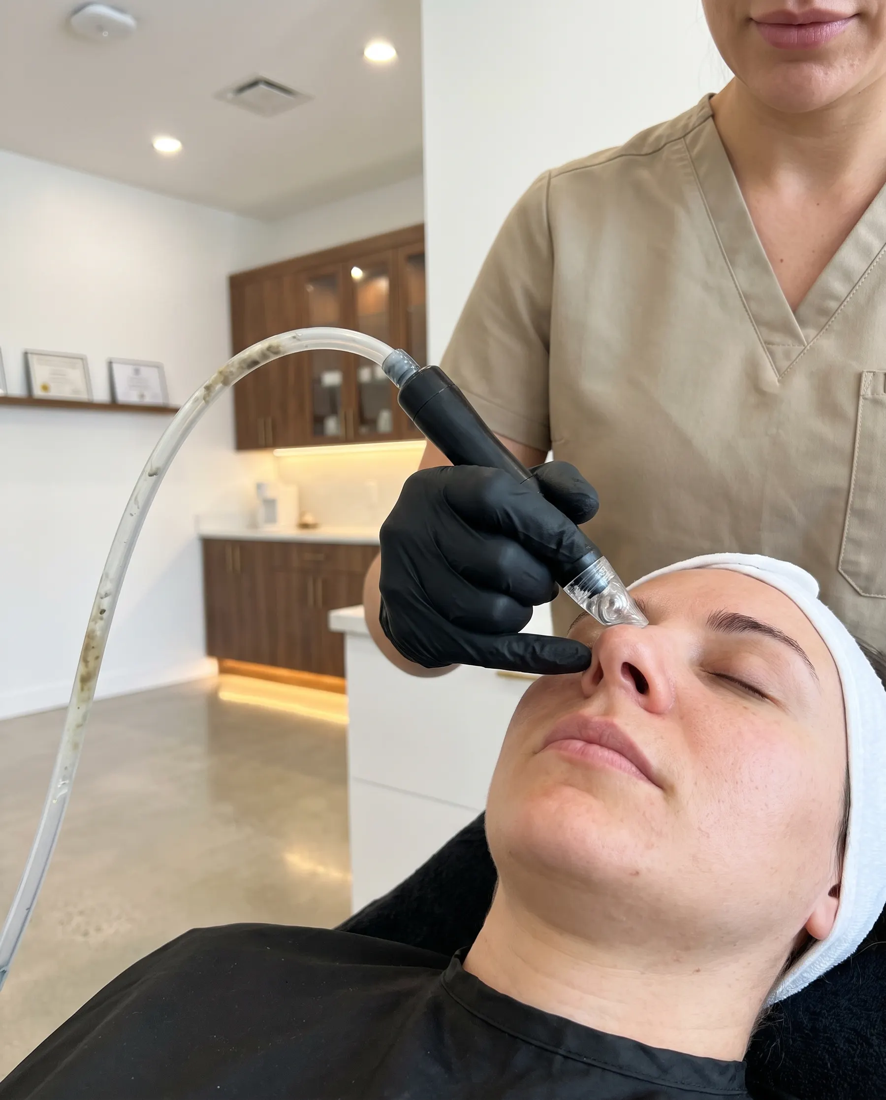 The extraction tip beside the nose, tubing in view