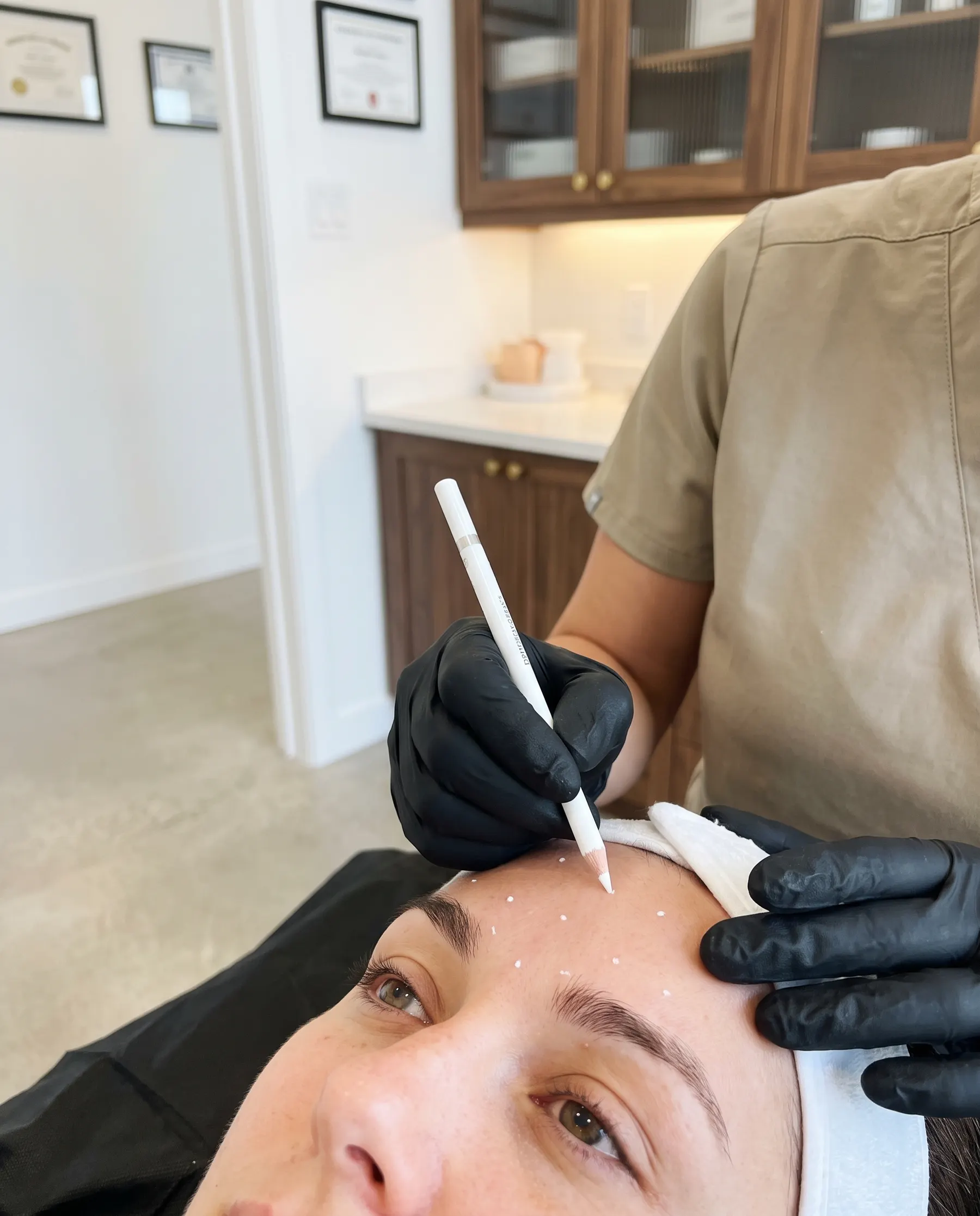 The forehead marked out with a skin pencil, close framing