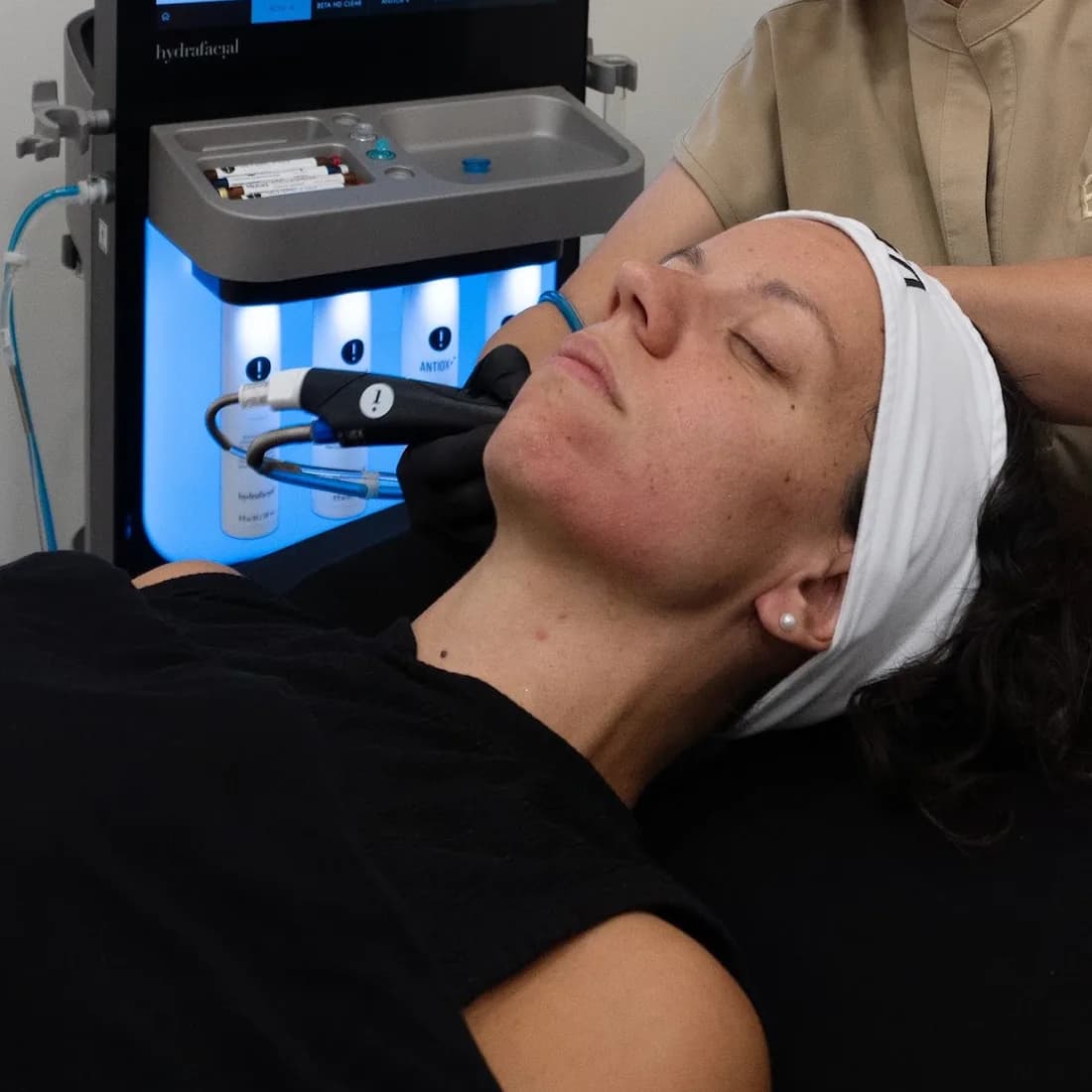The Hydrafacial tip on a client's cheek, the device behind her