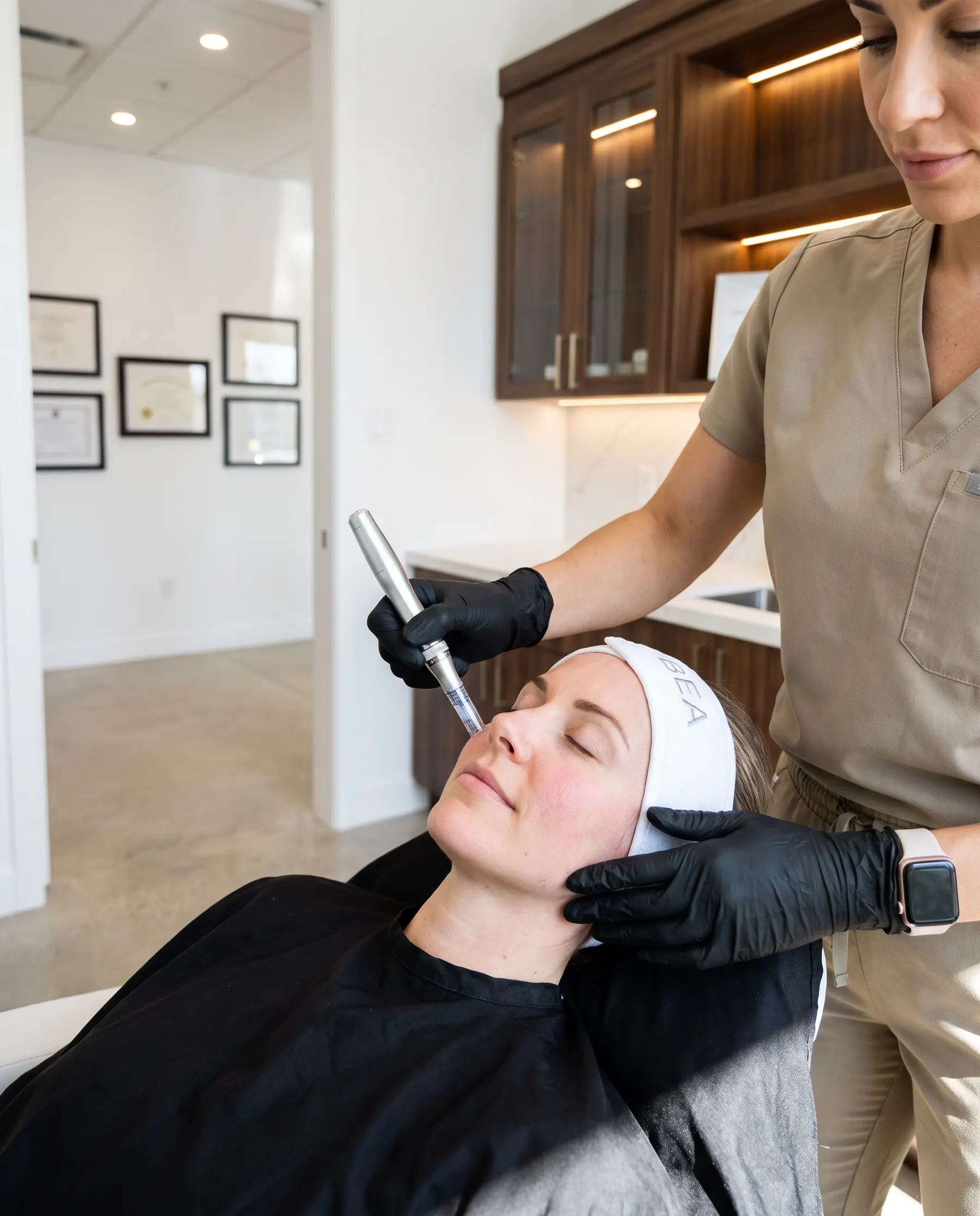 Stylo de microneedling passé sur la joue d'une cliente allongée