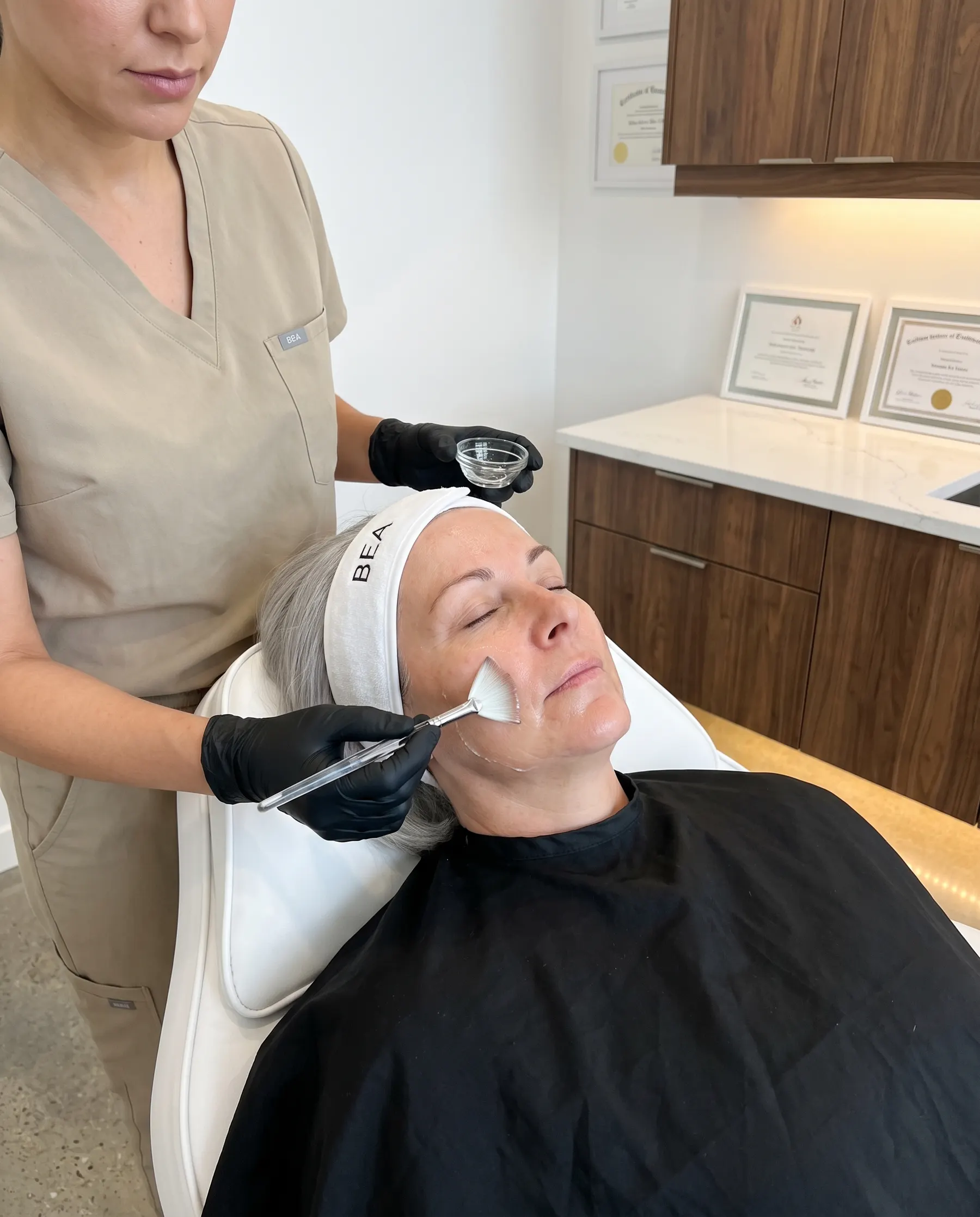 Peel solution spread across the cheek with a flat brush